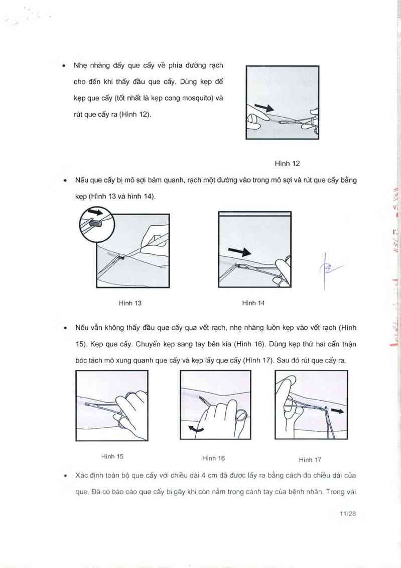 thông tin, cách dùng, giá thuốc Implanon NXT - ảnh 12