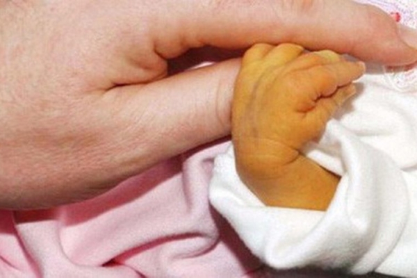 Vàng da ở trẻ sơ sinh có nguy hiểm?