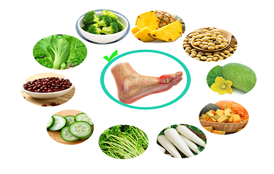 Người bệnh gout tránh ăn gì?