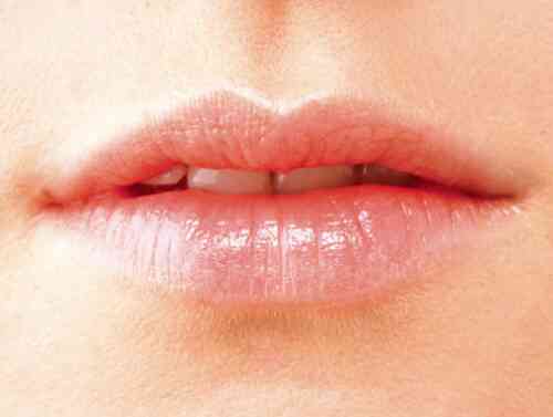Nguyên nhân gây viêm môi